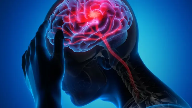 Gesund mit Felix (27): Migräne – mehr als Kopfschmerz