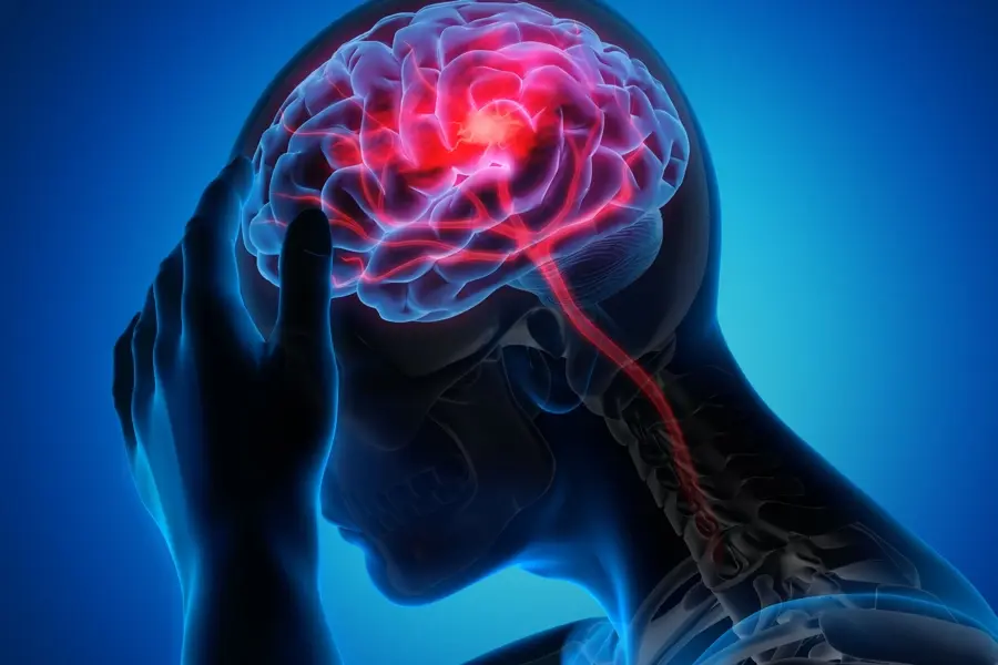 3 Gesund mit Felix (27): Migräne – mehr als Kopfschmerz